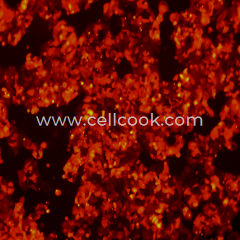 MCF7-RFP示蹤穩(wěn)定細胞株（STR鑒定正確）