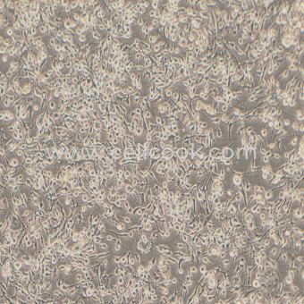 MDA-MB-436人乳腺腺癌細(xì)胞（STR鑒定正確）