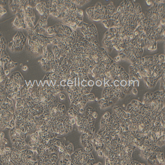 ZR-75-1人乳腺導(dǎo)管癌細胞（STR鑒定正確）