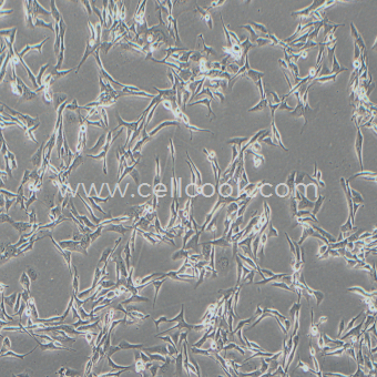 HCC38人乳腺導(dǎo)管癌細胞（STR鑒定正確）