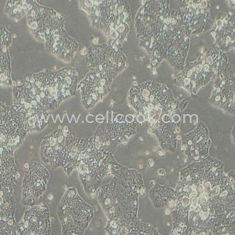 NCI-N87人胃癌細(xì)胞（STR鑒定正確）