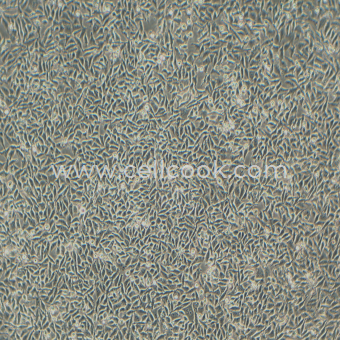 RKO人結(jié)腸癌細(xì)胞（STR鑒定正確）