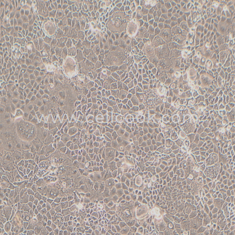 Caco-2人結(jié)直腸腺癌細(xì)胞（STR鑒定正確）