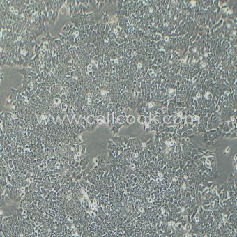 HCT-116人結(jié)直腸腺癌細(xì)胞（STR鑒定正確）