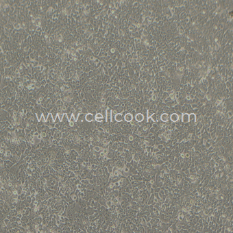 HCT-116-LUC示蹤穩(wěn)定細胞株（STR鑒定正確）