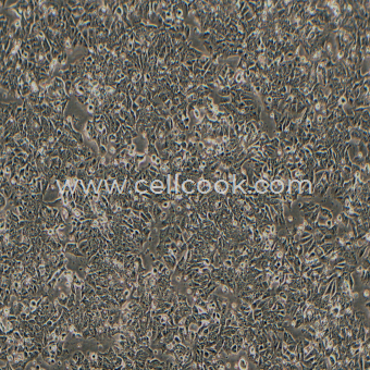 HCT-15人結(jié)直腸腺癌上皮細(xì)胞（STR鑒定正確）