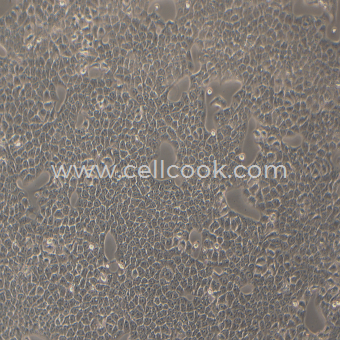 Kyse-510人食管癌細(xì)胞（STR鑒定正確）