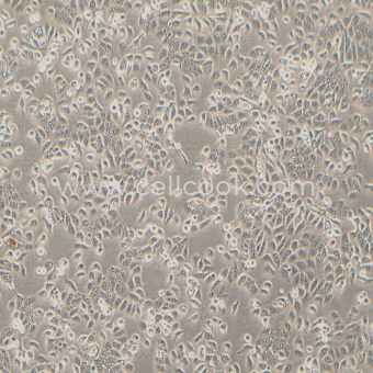 Ec109人食管鱗癌細胞（STR鑒定正確）