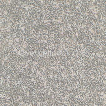 Kyse-450人食管鱗癌細胞（STR鑒定正確）