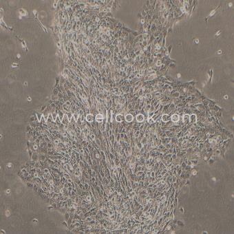 SAS人舌鱗癌細胞（STR鑒定正確）