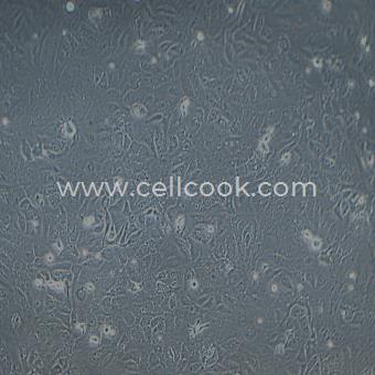 SK-OV-3-LUC示蹤穩(wěn)定細胞株（STR鑒定正確）