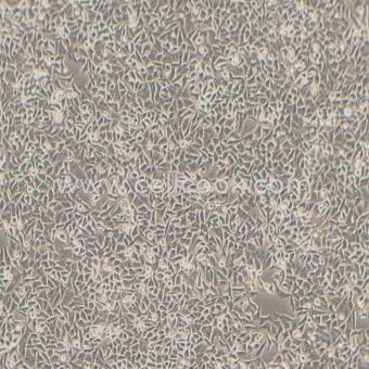 HEp-2 人喉癌細(xì)胞