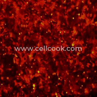 SK-OV-3-RFP示蹤穩(wěn)定細胞株（STR鑒定正確）