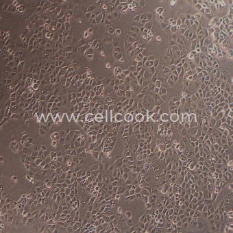 NIH/OVCAR-3人卵巢腺癌細胞（STR鑒定正確）