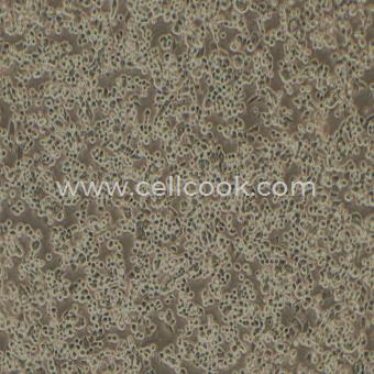 A2780人卵巢癌細胞（STR鑒定正確）