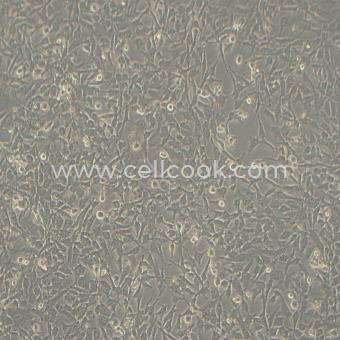 ES-2人卵巢透明細胞癌細胞（STR鑒定正確）