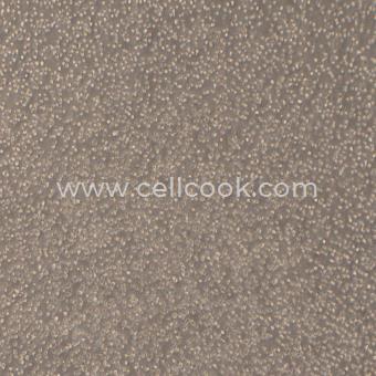 COC1人卵巢癌細(xì)胞（STR鑒定正確）