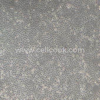 Hela人宮頸癌細胞（STR鑒定正確）