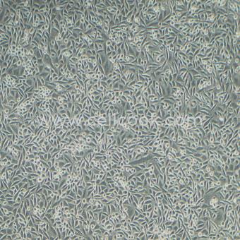 SiHa人子宮頸鱗狀細胞癌細胞（STR鑒定正確）