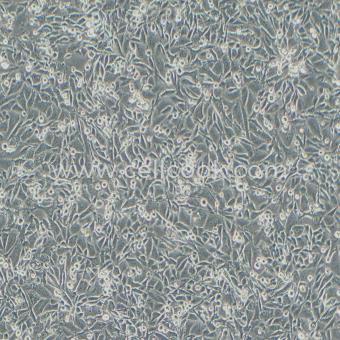 PC3人前列腺癌細胞（STR鑒定正確）