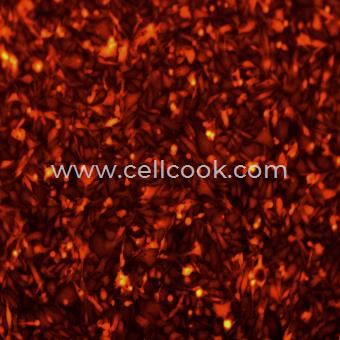 PC3-RFP示蹤穩(wěn)定細(xì)胞株（STR鑒定正確）