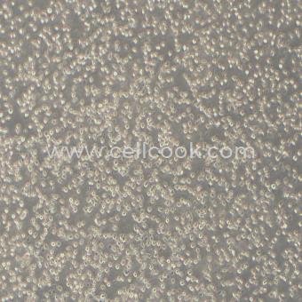 U937人組織細(xì)胞淋巴瘤細(xì)胞（STR鑒定正確）