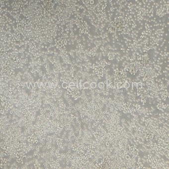 Raji黑人Burkitt淋巴瘤細(xì)胞（STR鑒定正確）