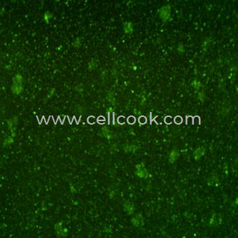 Raji-GFP示蹤穩(wěn)定細(xì)胞株（STR鑒定正確）