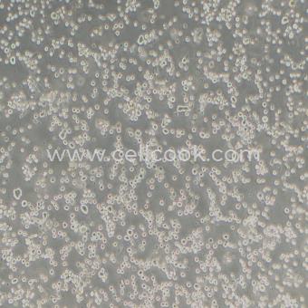 RPMI-8226人多發(fā)性骨髓瘤外周血B淋巴細(xì)胞（STR鑒定正確）