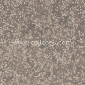 U266B1人骨髓瘤細(xì)胞（STR鑒定正確）