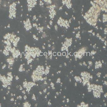 Farage人B淋巴瘤細(xì)胞（STR鑒定正確）