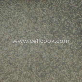 ST486人Burkitt's淋巴瘤細(xì)胞（STR鑒定正確）