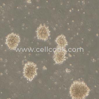 NK92/MI人自然殺傷細(xì)胞淋巴瘤細(xì)胞（STR鑒定正確）