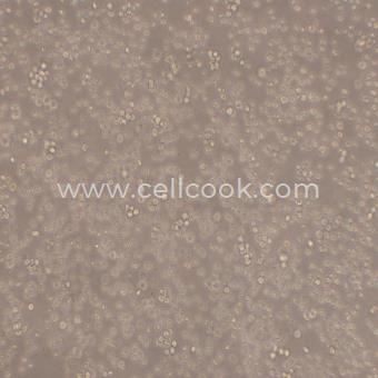 SU-DHL-8人B細(xì)胞淋巴瘤細(xì)胞（STR鑒定正確）