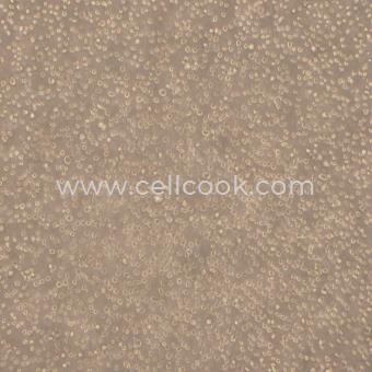 KARPAS-299人間變性大細(xì)胞淋巴瘤細(xì)胞（STR鑒定正確）