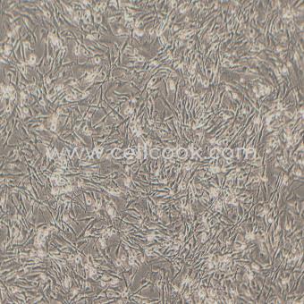 U-251 MG人神經(jīng)膠質(zhì)細(xì)胞瘤細(xì)胞（STR鑒定正確）