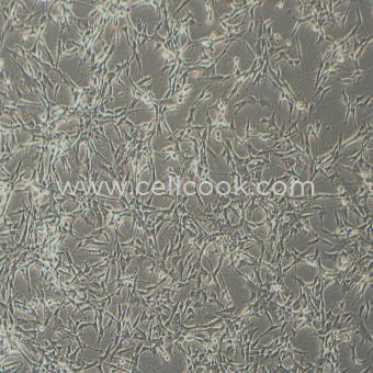 U-87 MG人腦星形膠質(zhì)母細(xì)胞瘤細(xì)胞（STR鑒定正確）