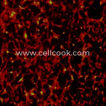 U-87 MG-RFP示蹤穩(wěn)定細(xì)胞株（STR鑒定正確）