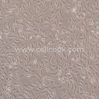 A-172人膠質(zhì)母細(xì)胞瘤細(xì)胞（STR鑒定正確）