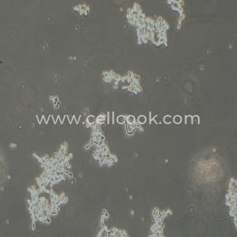 WERI-Rb-1人視網(wǎng)膜神經(jīng)膠質(zhì)瘤細胞（STR鑒定正確）