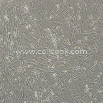 SF126人腦星形膠質(zhì)瘤細胞（STR鑒定正確）