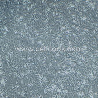 SF295人膠質(zhì)母細胞瘤細胞（STR鑒定正確）