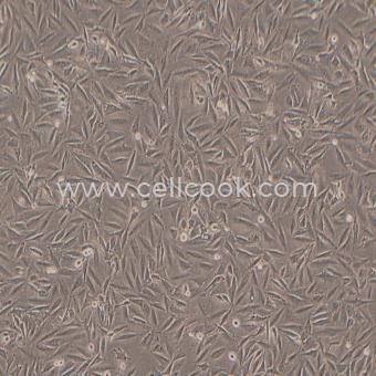 LN-229人膠質(zhì)瘤細胞（STR鑒定正確）