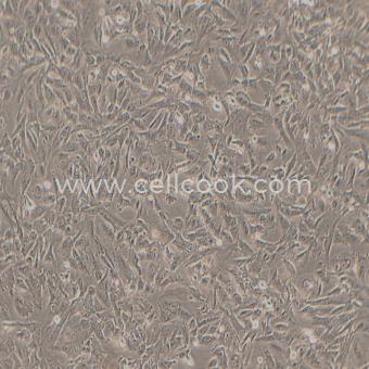 TJ905人膠質(zhì)瘤細胞（STR鑒定正確）