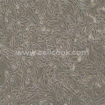 SK-MEL-28人皮膚黑色素瘤細(xì)胞（STR鑒定正確）