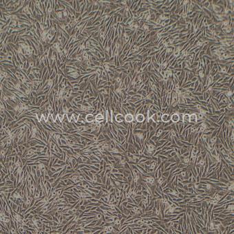 A2058人無黑素性黑色素瘤（淋巴轉(zhuǎn)移）（STR鑒定正確）