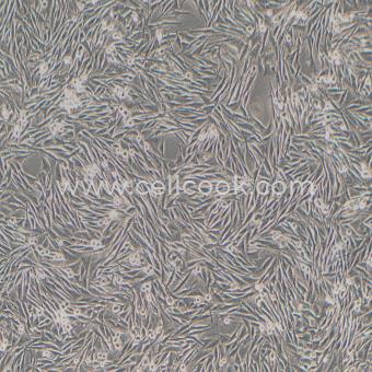 OCM-1人脈絡(luò)膜黑色素瘤細(xì)胞（STR鑒定正確）