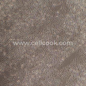 OMM2.3人脈絡(luò)膜黑色素瘤細(xì)胞（肝轉(zhuǎn)移灶）（STR鑒定正確）