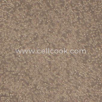 K562人慢性髓原白血病細(xì)胞（STR鑒定正確）