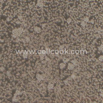 Jurkat E6-1人急性T淋巴細(xì)胞白血病細(xì)胞（STR鑒定正確）